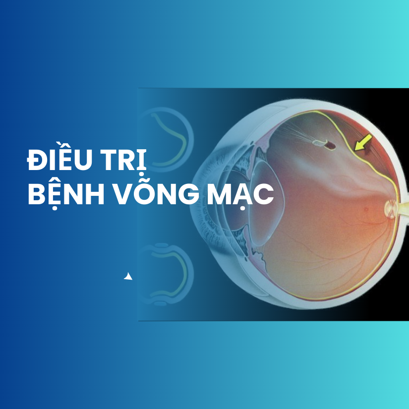 Bệnh võng mạc