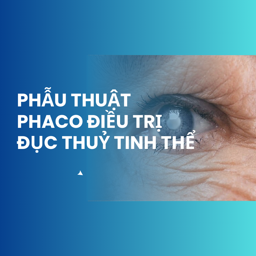 Phẫu thuật Phaco